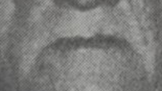 Ir. Pedro Benno Krein (1914-1993)